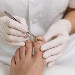 Що таке ортоніксия і як Baehr допомагає в лікуванні нігтьових патологій